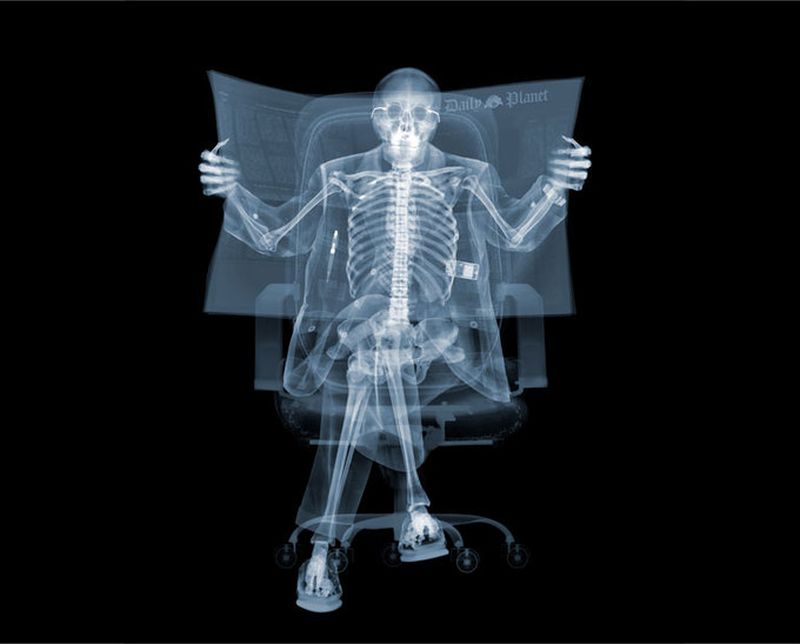 Рентгеновский взгляд на мир Ника Визи