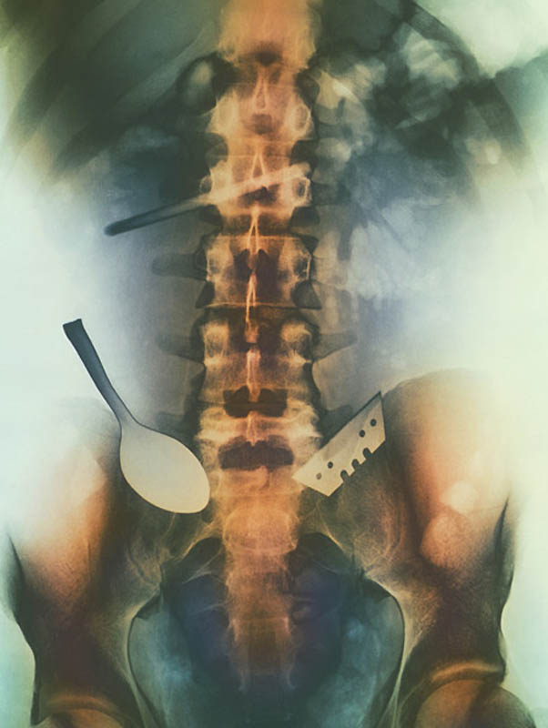 Фотография: Cамые странные рентгеновские снимки №5 - BigPicture.ru