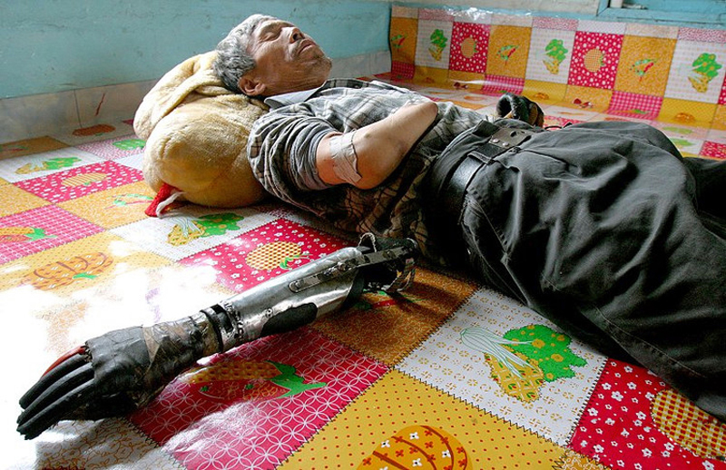 Фотография: Китайский крестьянин сделал себе бионические руки №12 - BigPicture.ru
