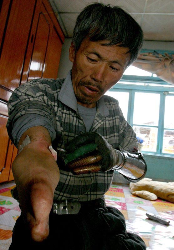 Фотография: Китайский крестьянин сделал себе бионические руки №7 - BigPicture.ru