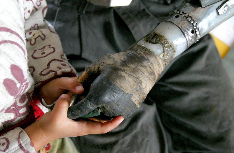 Фотография: Китайский крестьянин сделал себе бионические руки №6 - BigPicture.ru