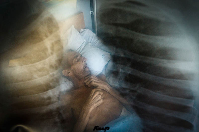 Фотография: Эпидемия туберкулеза в Украине №2 - BigPicture.ru