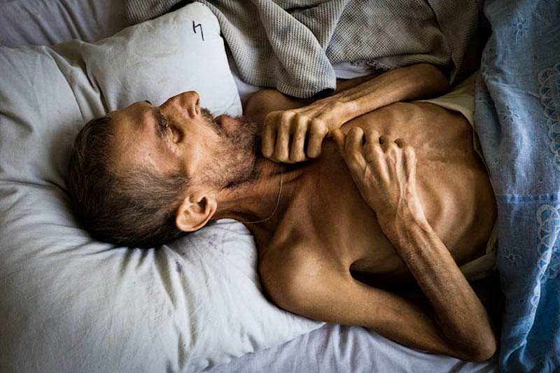 Фотография: Эпидемия туберкулеза в Украине №11 - BigPicture.ru