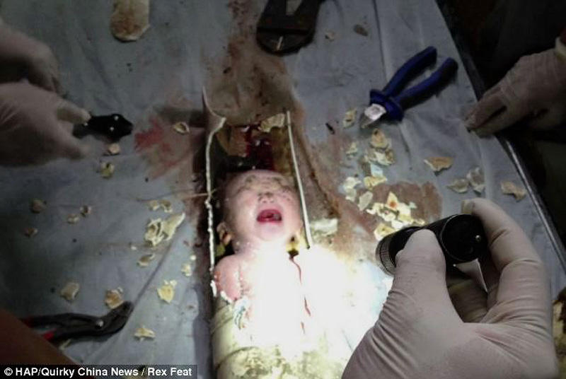 Фотография: В Китае спасли новорожденного, которого смыли в унитаз №2 - BigPicture.ru