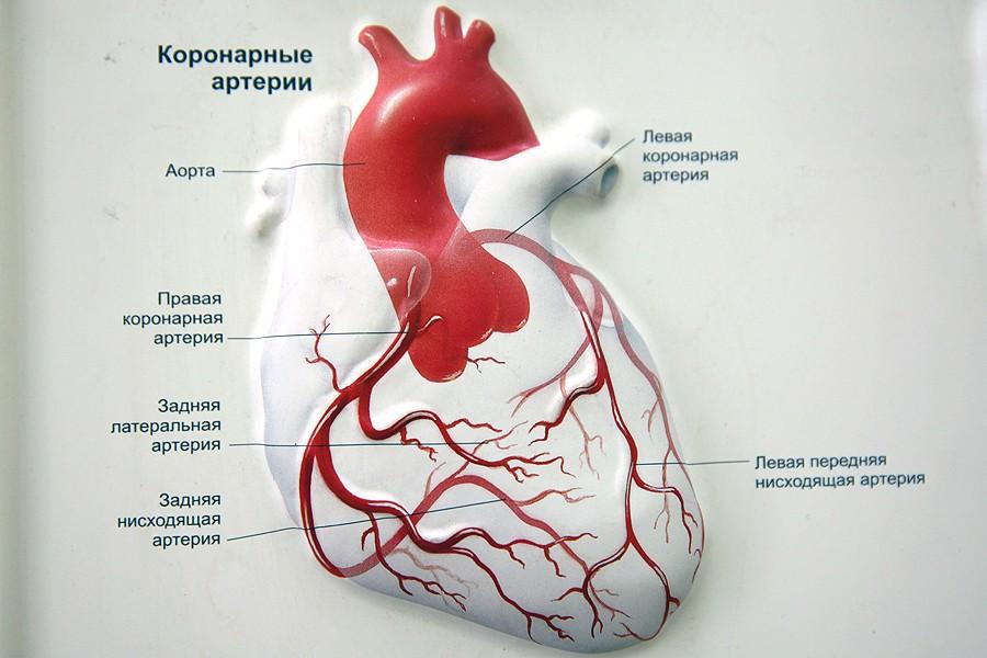 Фотография: Дела сердечные, или Операция без распилов №3 - BigPicture.ru
