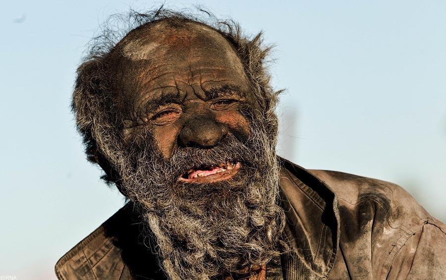 Фотография: Как выглядит человек, который не мылся 60 лет №3 - BigPicture.ru