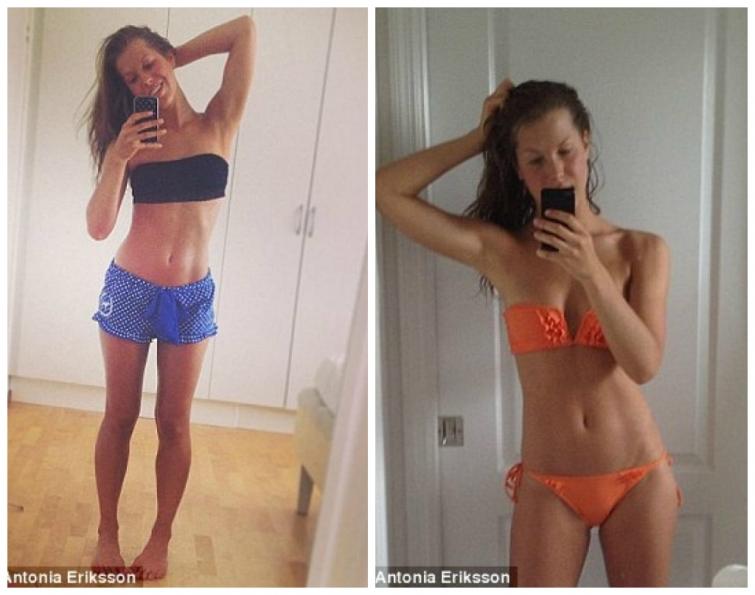 Фотография: Instagram недели: Победа над анорексией №5 - BigPicture.ru