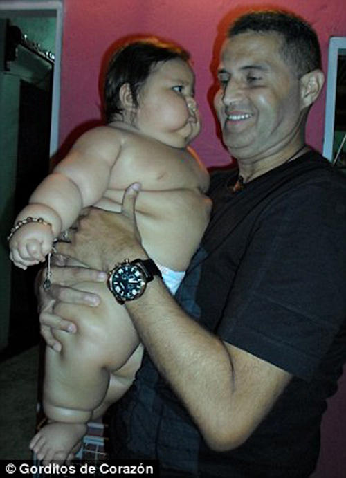 Фотография: Ожиревшего 8-месячного малыша изъяли у родителей №8 - BigPicture.ru
