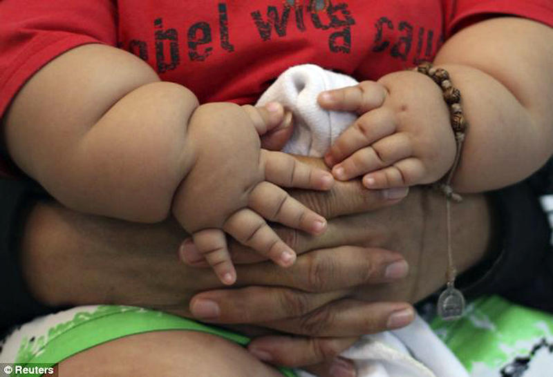 Фотография: Ожиревшего 8-месячного малыша изъяли у родителей №4 - BigPicture.ru