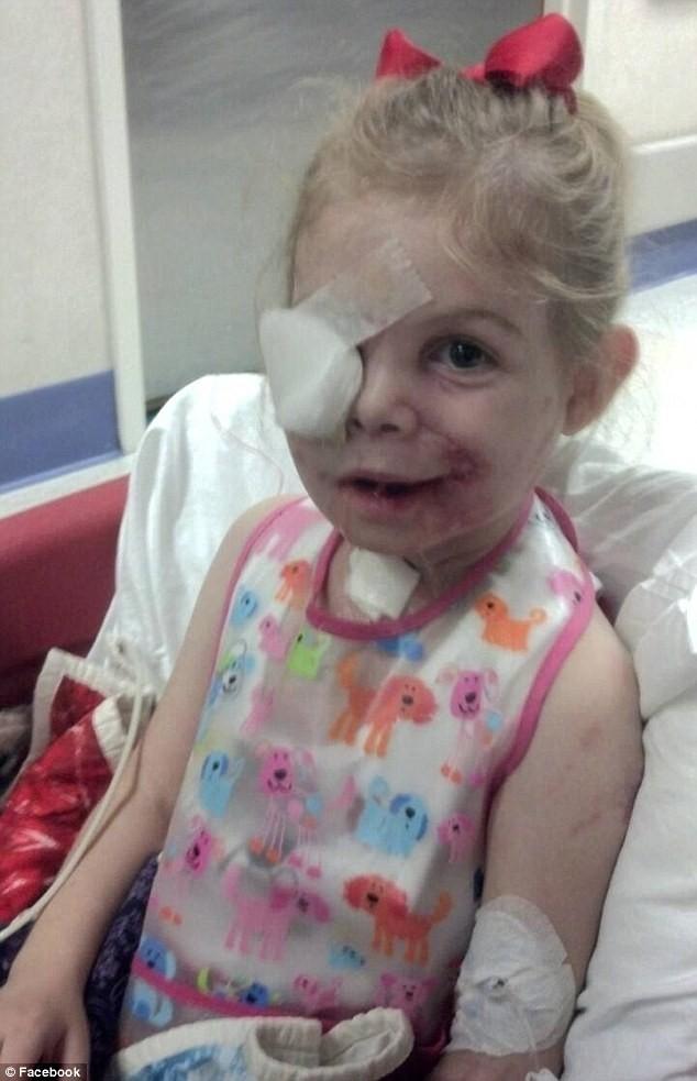 Фотография: 3-летнюю девочку, изуродованную питбулями, выгнали из закусочной из-за ее внешности №9 - BigPicture.ru