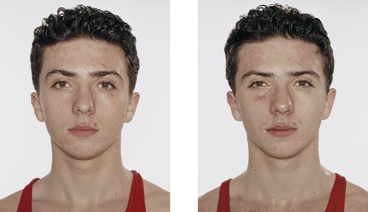 Фотография: Юные боксеры: до и после боя №3 - BigPicture.ru