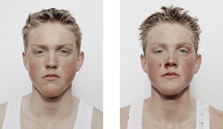 Фотография: Юные боксеры: до и после боя №4 - BigPicture.ru