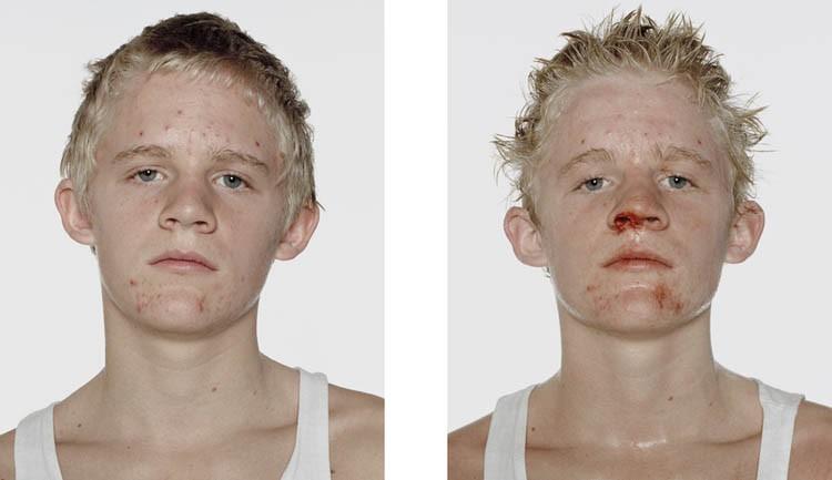 Фотография: Юные боксеры: до и после боя №6 - BigPicture.ru