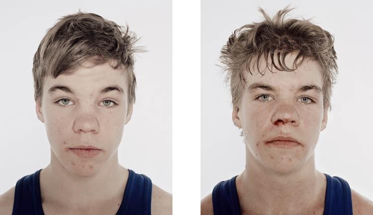 Фотография: Юные боксеры: до и после боя №9 - BigPicture.ru