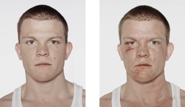 Фотография: Юные боксеры: до и после боя №14 - BigPicture.ru