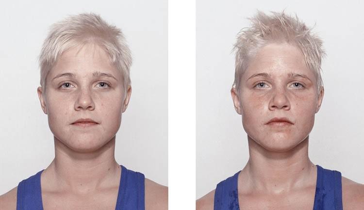 Фотография: Юные боксеры: до и после боя №17 - BigPicture.ru