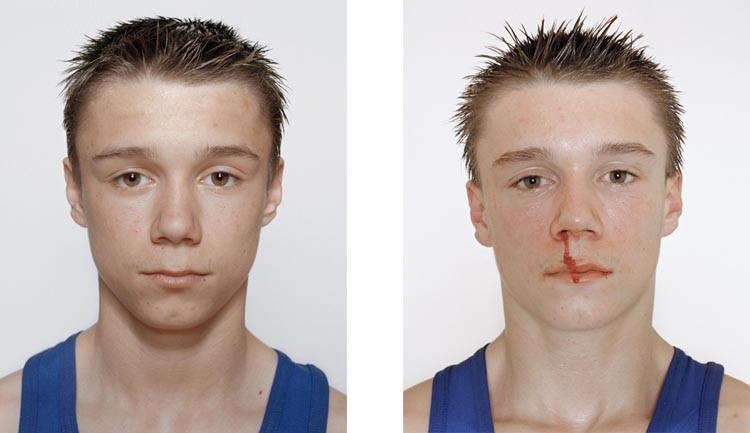 Фотография: Юные боксеры: до и после боя №25 - BigPicture.ru