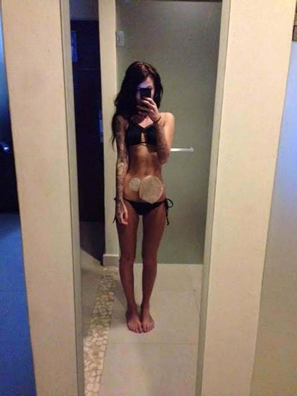 Фотография: Девушка, страдающая от серьезного заболевания, стала интернет-сенсацией №6 - BigPicture.ru