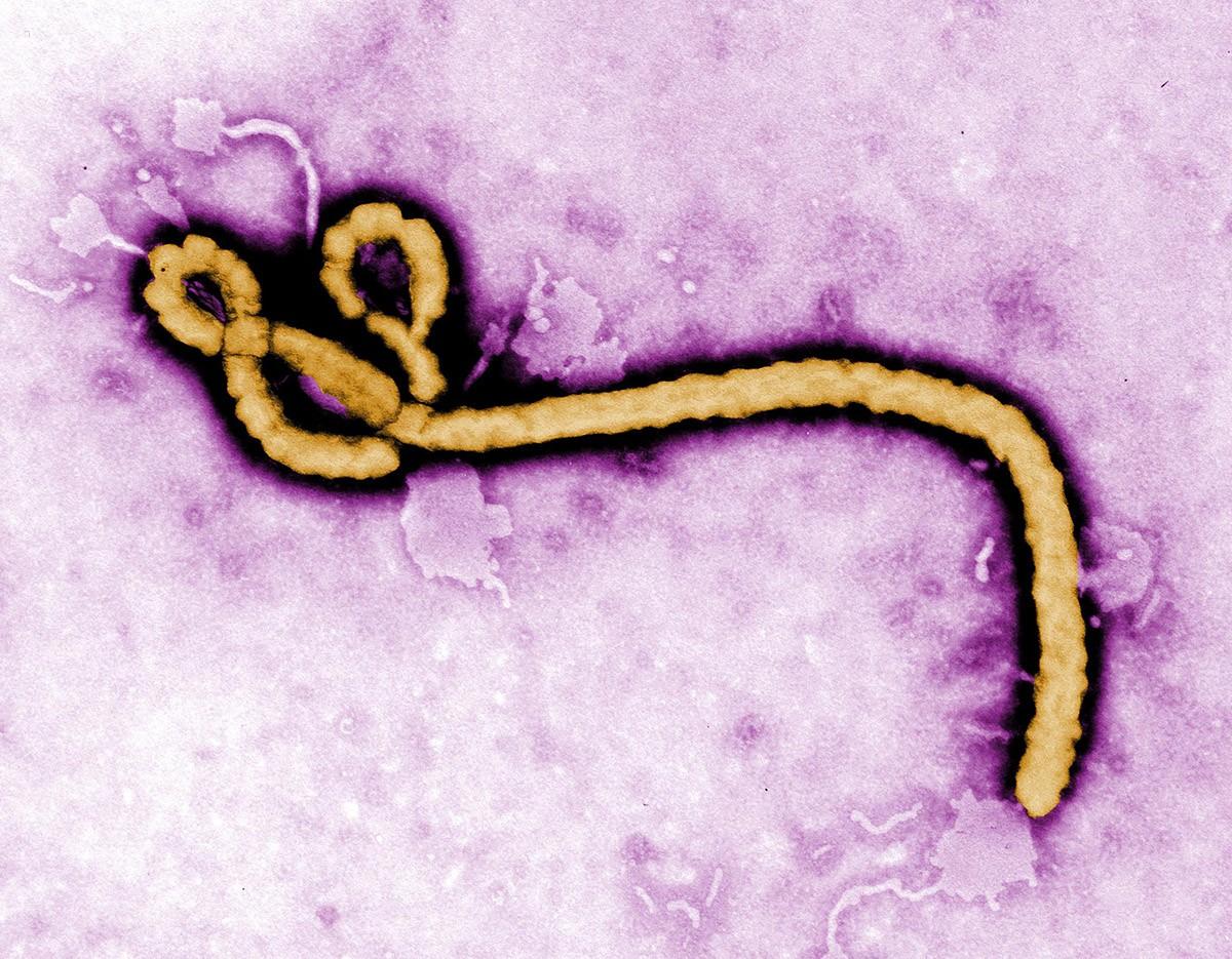 Фотография: Вирус Эбола: мир лихорадит №7 - BigPicture.ru