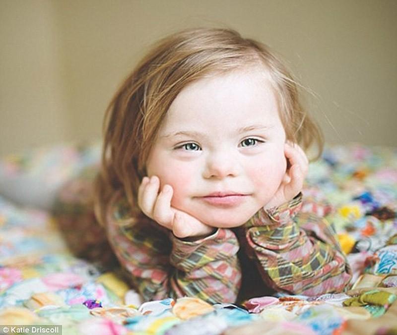 Фотография: Мама девочки с синдромом Дауна устроила фотосессию для детей-инвалидов к новому учебному году №4 - BigPicture.ru