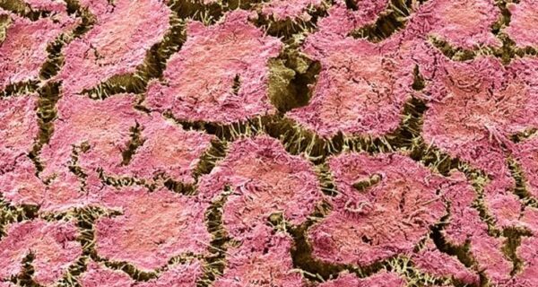 То, что таится у вас во рту, очень крупным планом