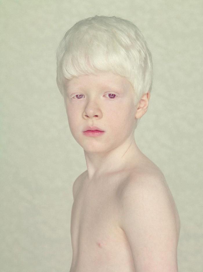 Фотография: Не такие, как все: люди-альбиносы №3 - BigPicture.ru