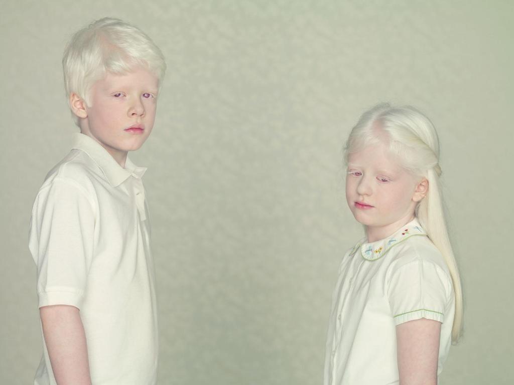 Фотография: Не такие, как все: люди-альбиносы №4 - BigPicture.ru