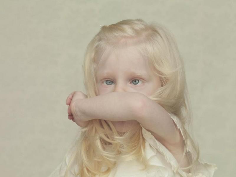 Фотография: Не такие, как все: люди-альбиносы №1 - BigPicture.ru