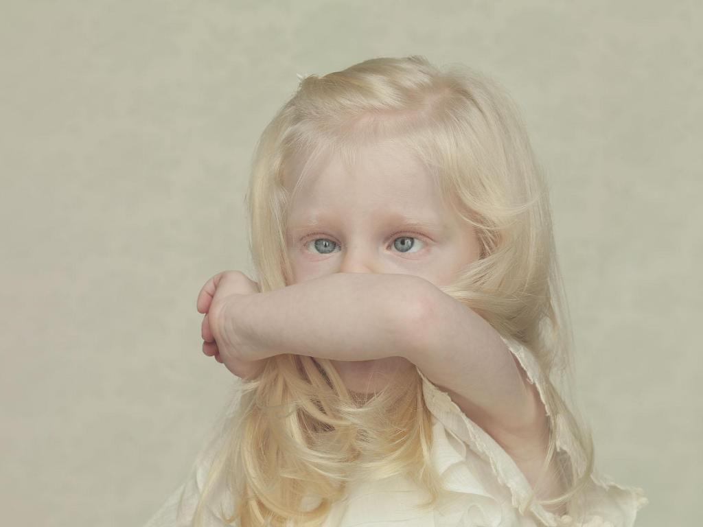 Фотография: Не такие, как все: люди-альбиносы №6 - BigPicture.ru