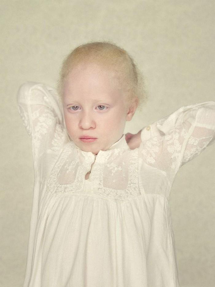 Фотография: Не такие, как все: люди-альбиносы №7 - BigPicture.ru