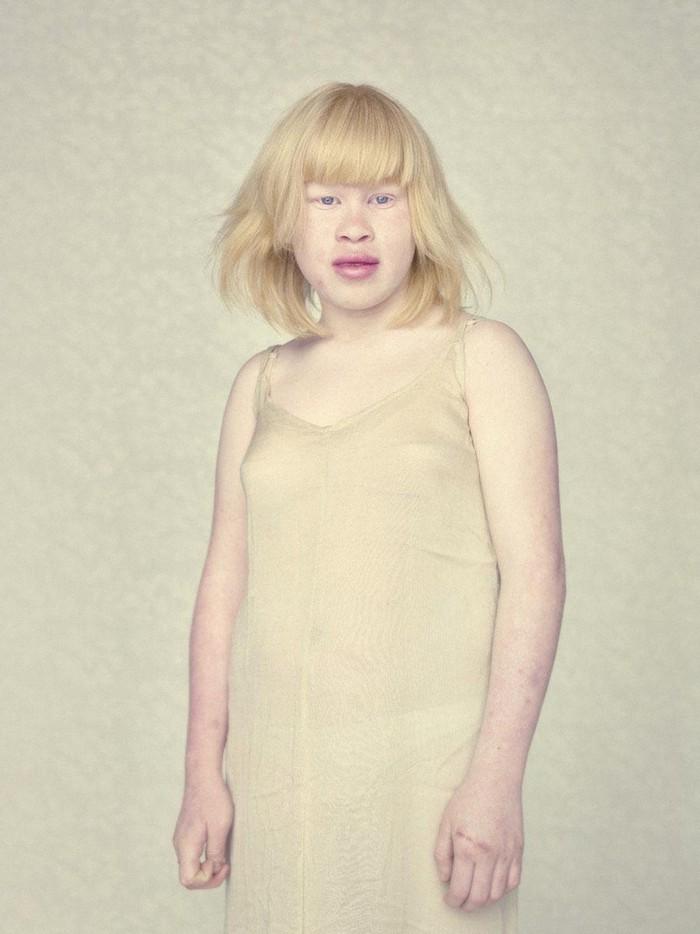 Фотография: Не такие, как все: люди-альбиносы №9 - BigPicture.ru