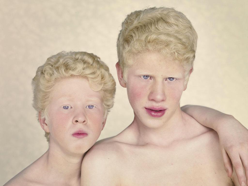 Фотография: Не такие, как все: люди-альбиносы №12 - BigPicture.ru