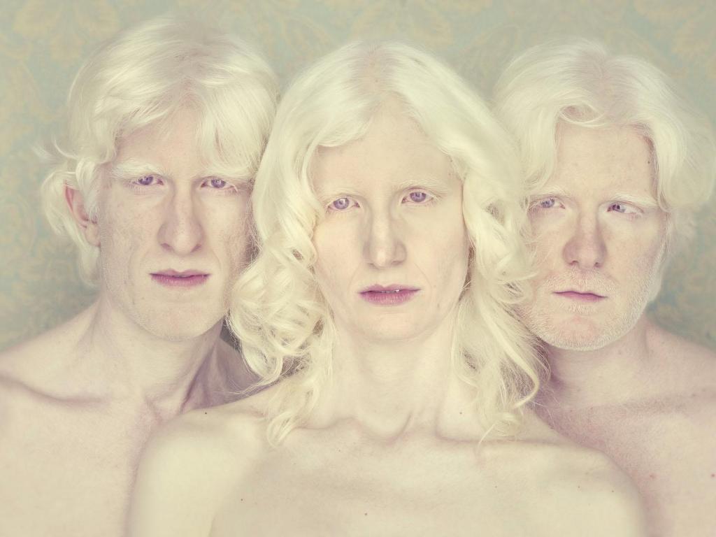 Фотография: Не такие, как все: люди-альбиносы №13 - BigPicture.ru