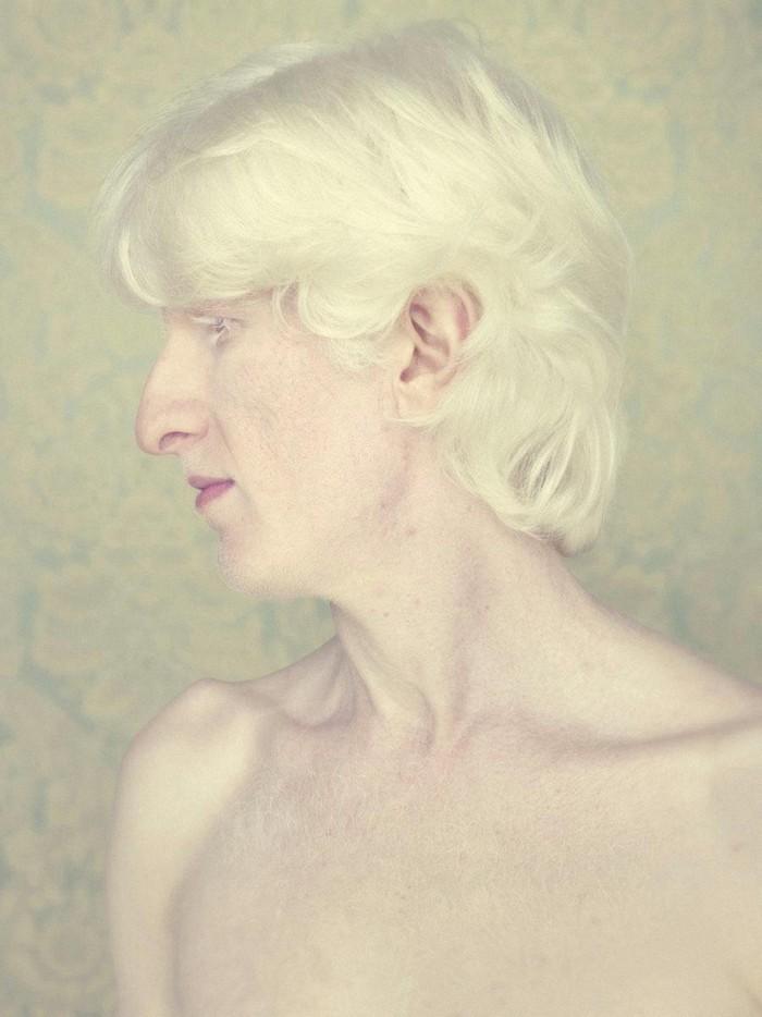 Фотография: Не такие, как все: люди-альбиносы №14 - BigPicture.ru