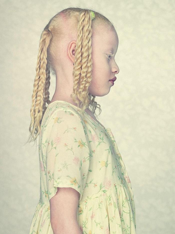 Фотография: Не такие, как все: люди-альбиносы №16 - BigPicture.ru