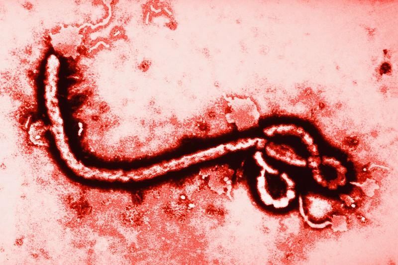 Фотография: 10 фактов про вирус Эбола, которые стоит узнать прямо сегодня №1 - BigPicture.ru
