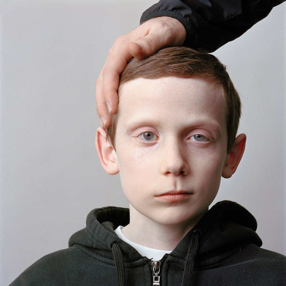 Фотография: About Face: фотопортреты людей, страдающих параличом №2 - BigPicture.ru