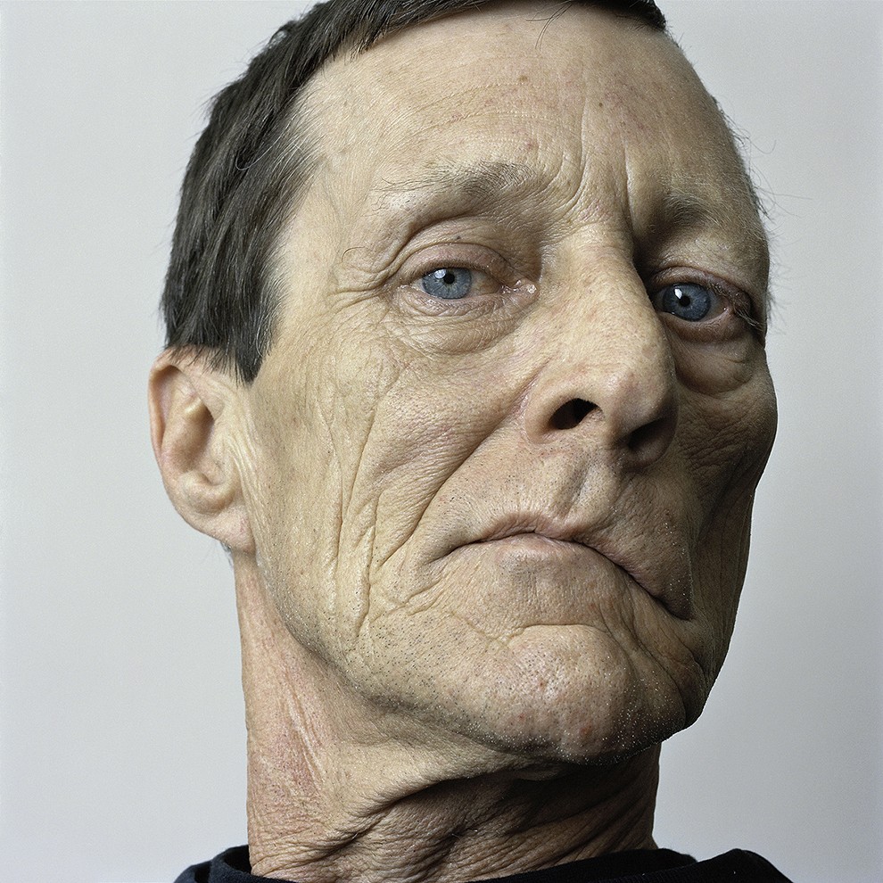 Фотография: About Face: фотопортреты людей, страдающих параличом №7 - BigPicture.ru