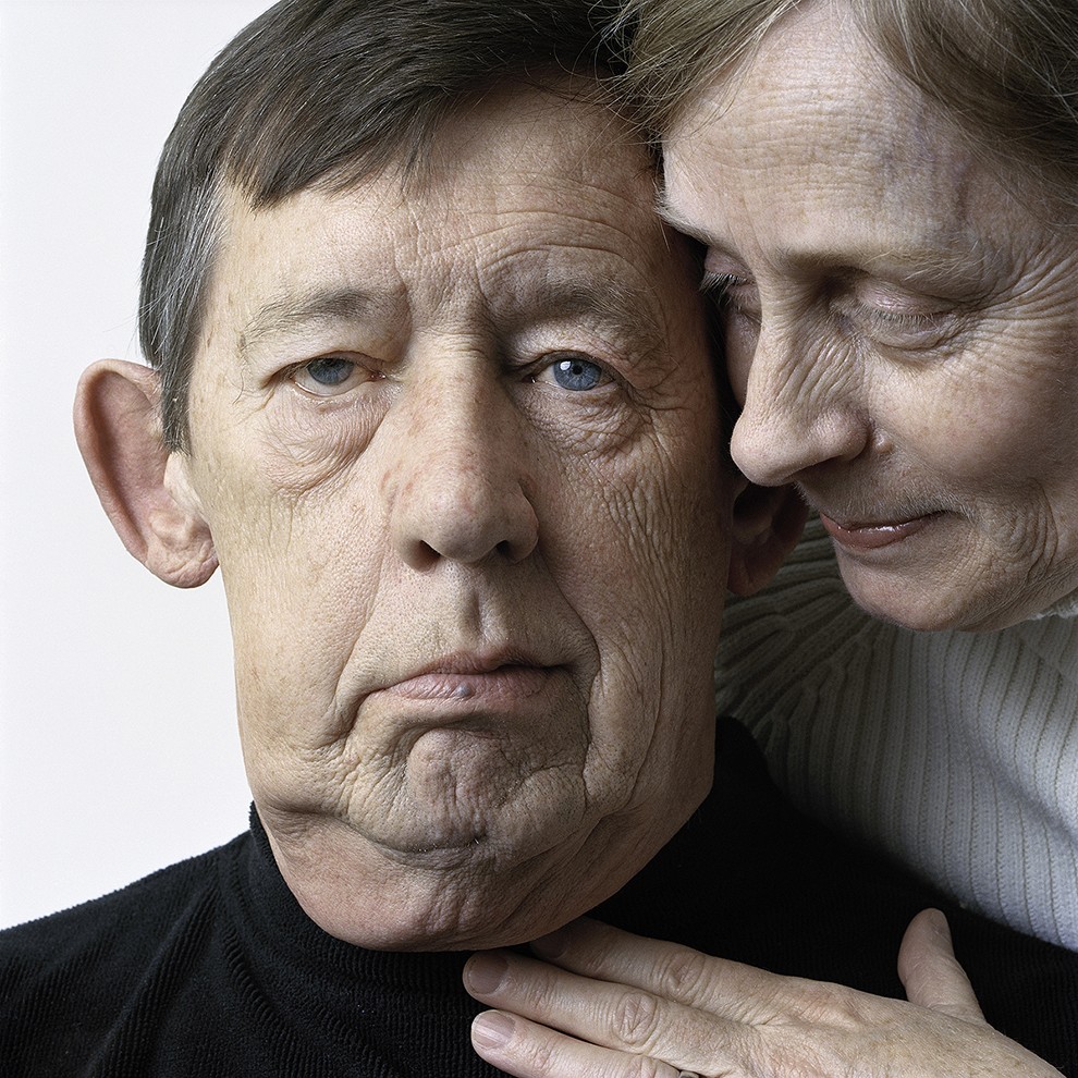 Фотография: About Face: фотопортреты людей, страдающих параличом №10 - BigPicture.ru