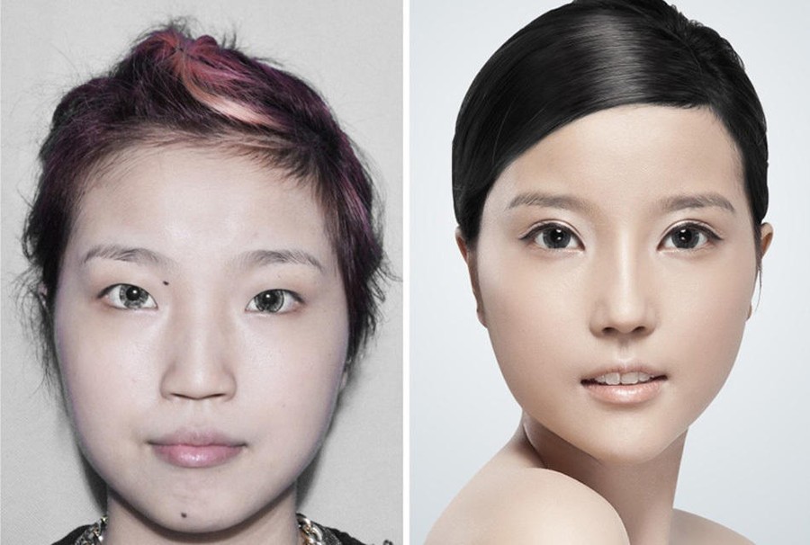 Фотография: Стандарты красоты: китаянки после пластики №6 - BigPicture.ru