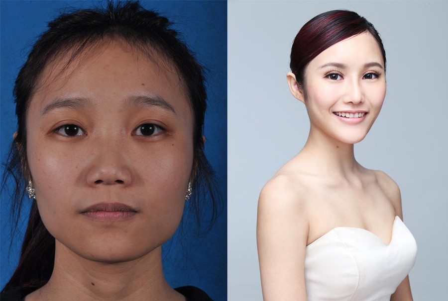 Фотография: Стандарты красоты: китаянки после пластики №7 - BigPicture.ru