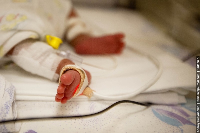 Фотография: Как спасают новорожденных. Репортаж из детской реанимации №1 - BigPicture.ru