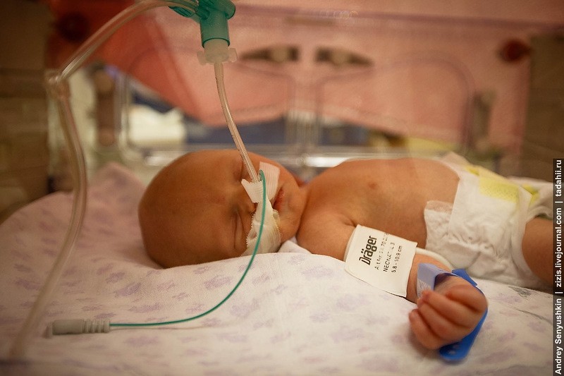 Как спасают новорожденных. Репортаж из детской реанимации