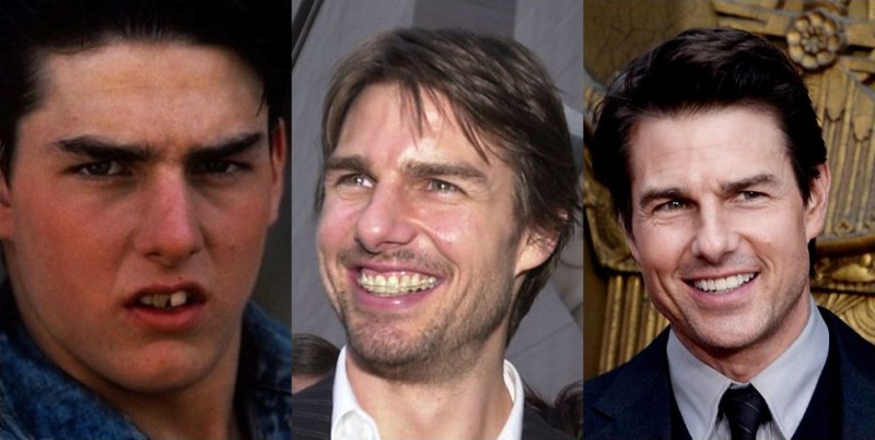 Фотография: Эти знаменитости покажут вам, как кардинально брекеты меняют улыбку №1 - BigPicture.ru