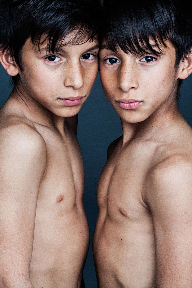 Фотография: Завораживающие портреты близнецов №28 - BigPicture.ru