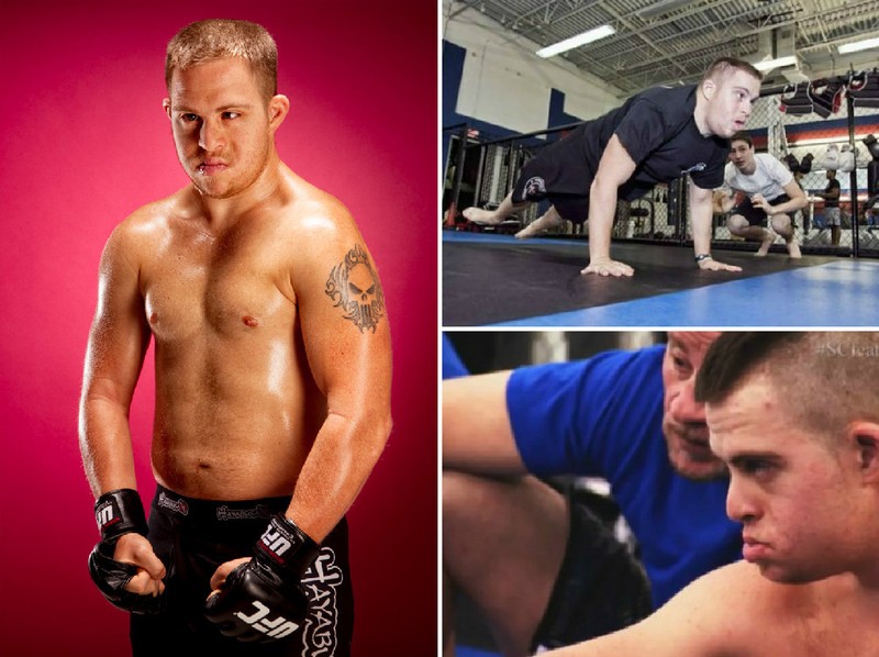 Фотография: 6 бойцов MMA, которые добились успеха вопреки своей неполноценности №7 - BigPicture.ru