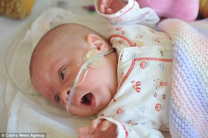 Фотография: Удивительная история крошечной малышки, которая выжила несмотря ни на что №6 - BigPicture.ru
