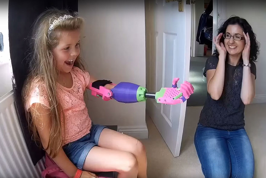 Фотография: Девочка получила 3D-протез от дизайнера, у которого также нет руки №2 - BigPicture.ru