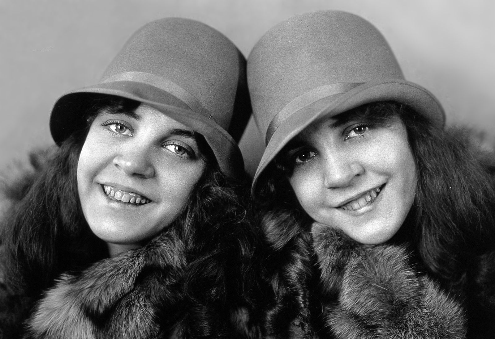 Фотография: Жизнь сиамских близнецов Дейзи и Виолетты Хилтон №3 - BigPicture.ru