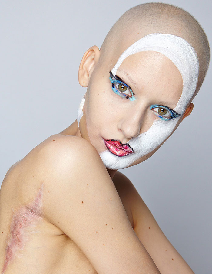 Фотография: Врачи сказали модели сделать аборт после того, как ей удалили 95% челюсти из-за рака, — и вот что она сделала №8 - BigPicture.ru